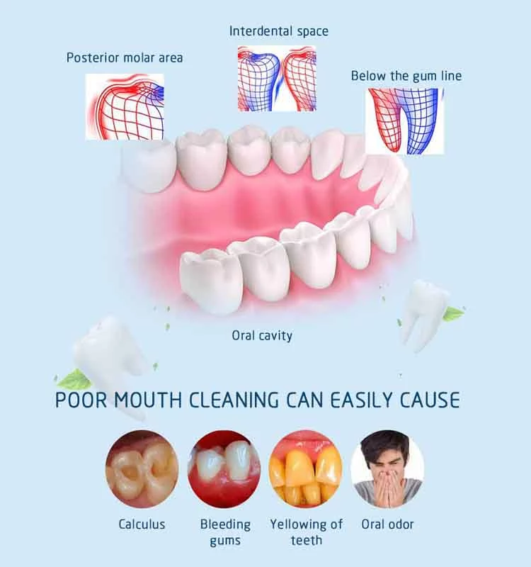 Importance of mouth Cleaning